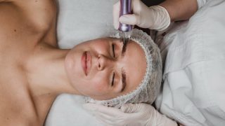 Cuidados após microagulhamento: cosmética profissional para otimizar a recuperação da pele