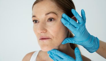 Tratamento de flacidez no rosto: produtos profissionais para protocolos de rejuvenescimento facial