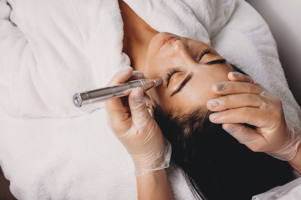 Cosmética para microagulhamento: produtos profissionais para recuperação e regeneração da pele